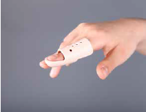 Mallet Finger Ateli